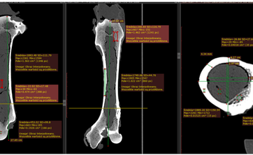 Korelacja własności mechanicznych kości zwierzęcych z pomiarami uzyskanymi w badaniu Ilościowej tomografii komputerowej (QCT)